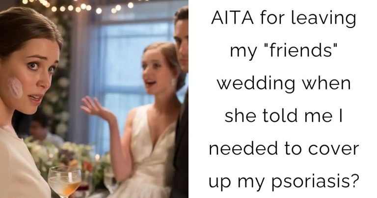 AITA for leaving my “friends” wedding when she told me I needed to cover up my psoriasis?