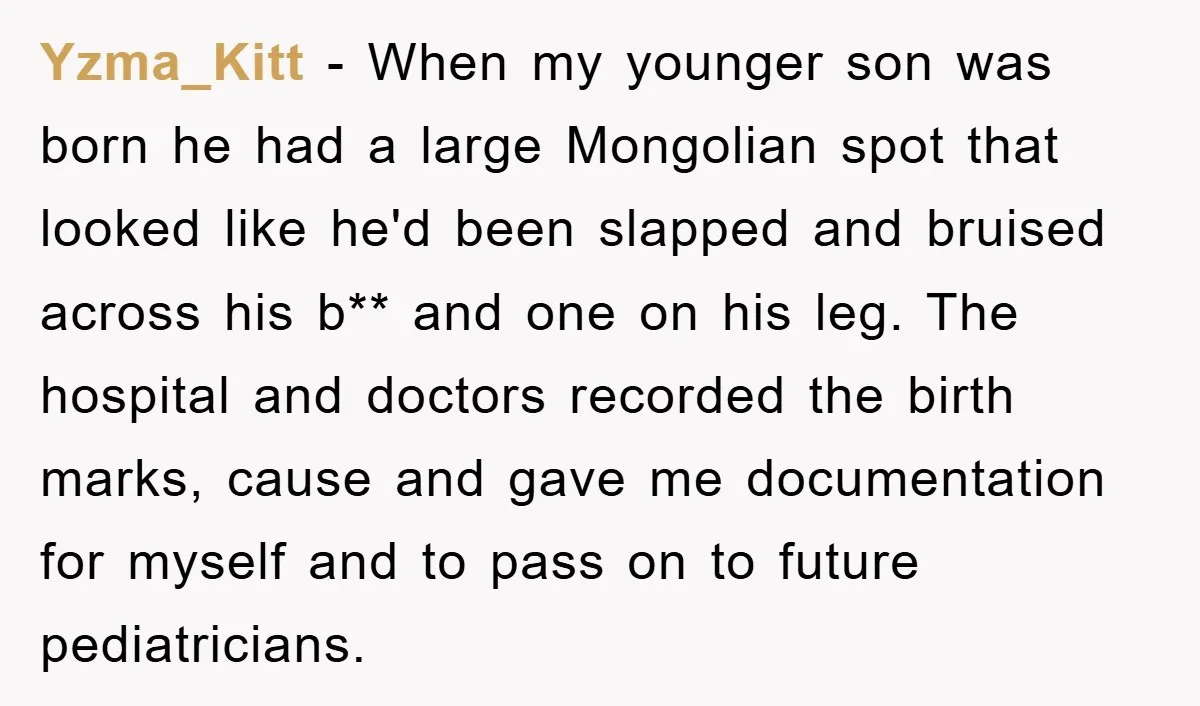 Yzma_Kitt − When my younger son was born he had a large Mongolian spot that looked like he'd been slapped and bruised across his b** and one on his leg....