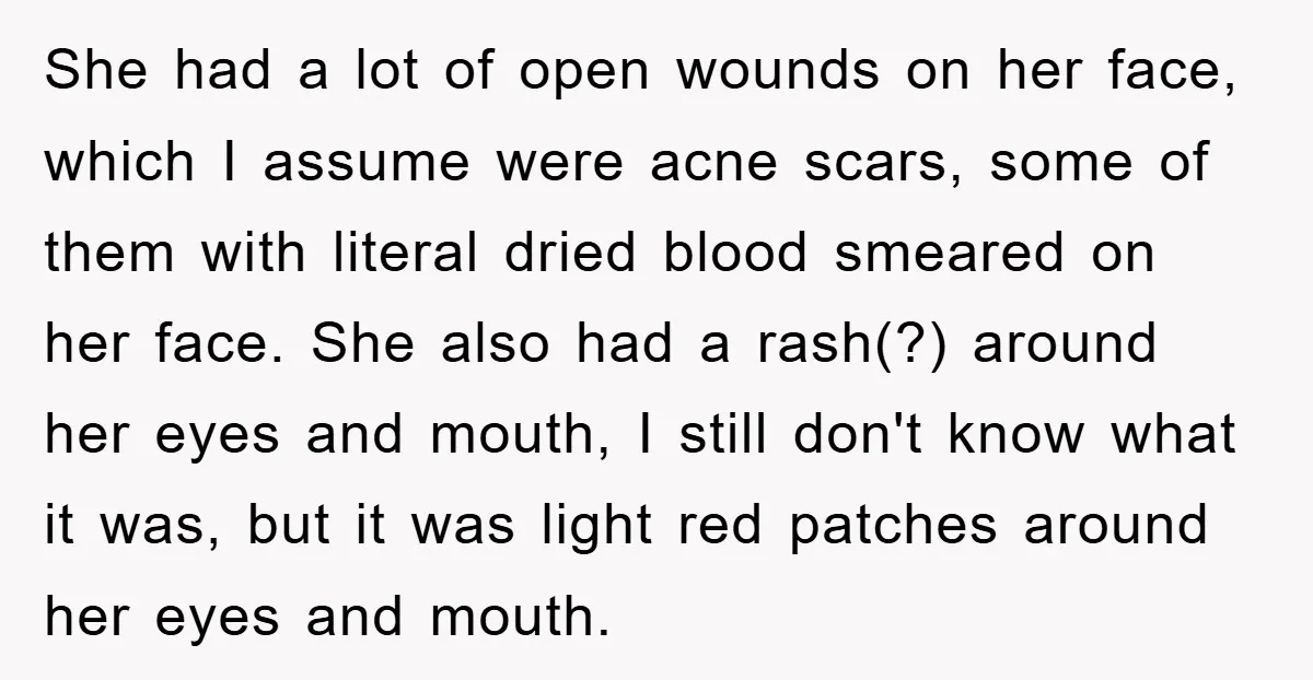 She had a lot of open wounds on her face, which I assume were acne scars, some of them with literal dried blood smeared on her face. She also had...