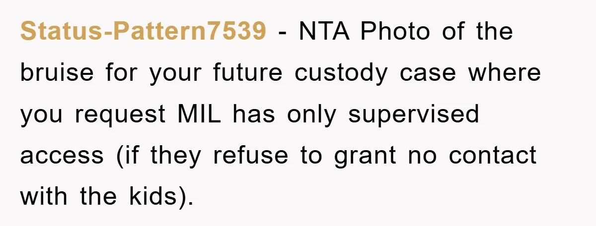 Status-Pattern7539 − NTA Photo of the bruise for your future custody case where you request MIL has only supervised access (if they refuse to grant no contact with the kids).
