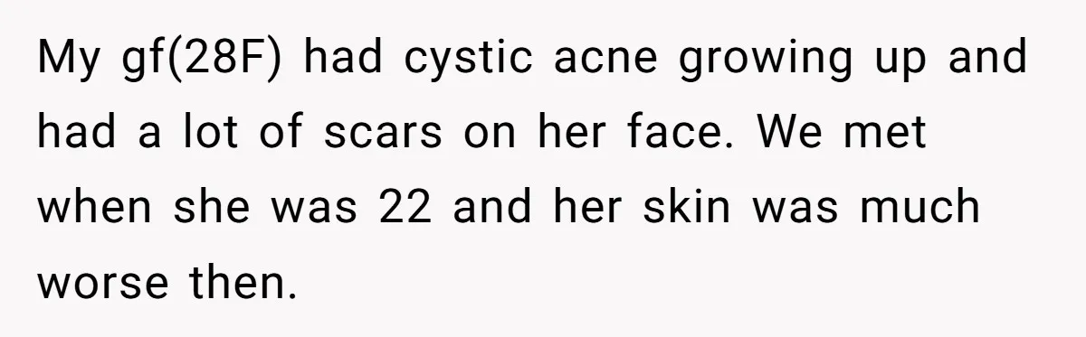 My gf(28F) had cystic acne growing up and had a lot of scars on her face. We met when she was 22 and her skin was much worse then.