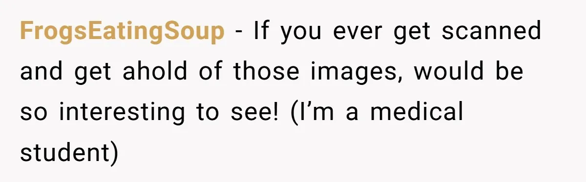 FrogsEatingSoup − If you ever get scanned and get ahold of those images, would be so interesting to see! (I’m a medical student)