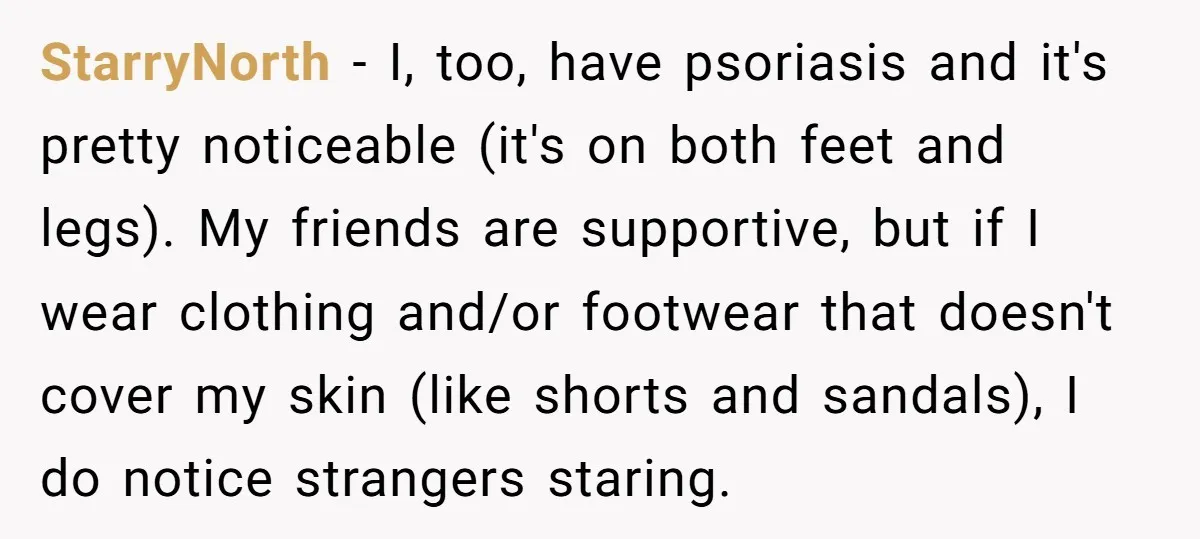 StarryNorth - I, too, have psoriasis and it's pretty noticeable (it's on both feet and legs). My friends are supportive, but if I wear clothing and/or footwear that doesn't cover...