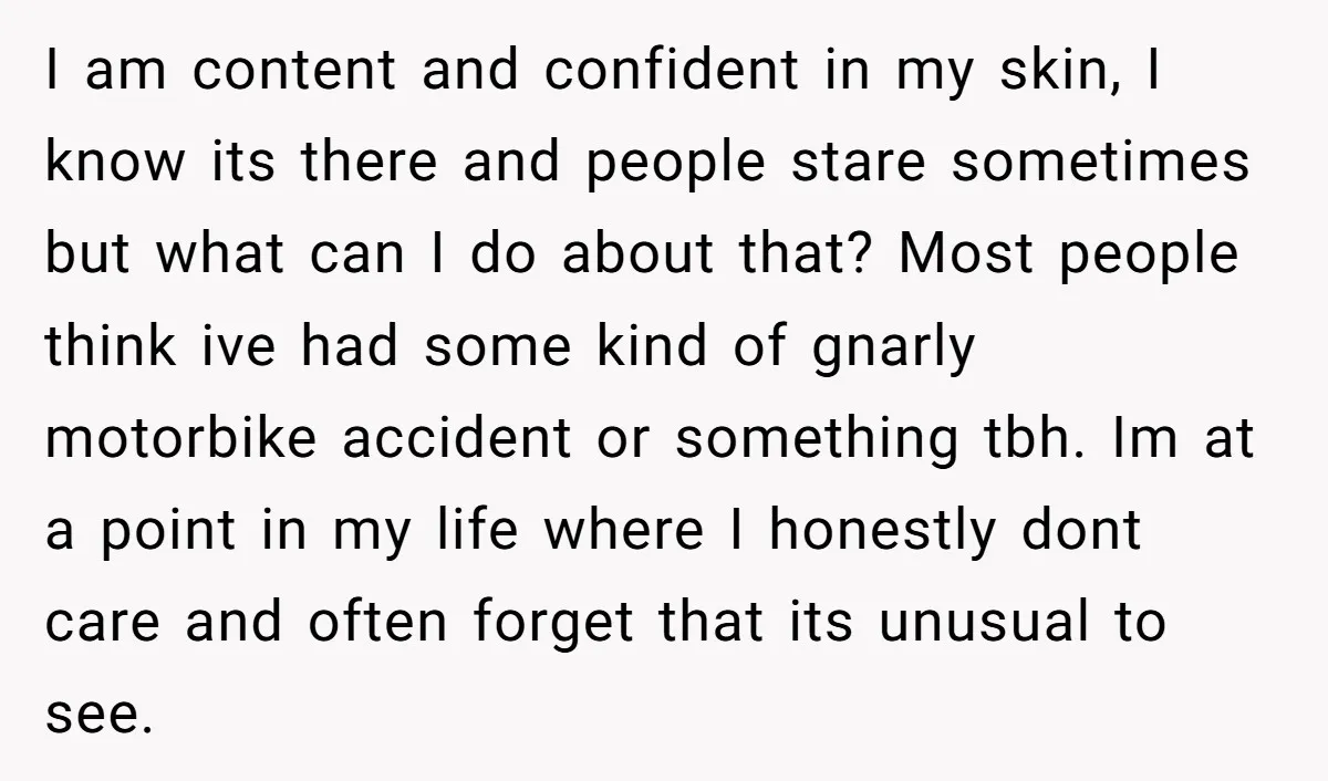 I am content and confident in my skin, I know its there and people stare sometimes but what can I do about that? Most people think ive had some kind...