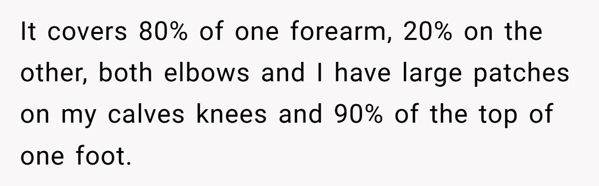 It covers 80% of one forearm, 20% on the other, both elbows and I have large patches on my calves knees and 90% of the top of one foot.