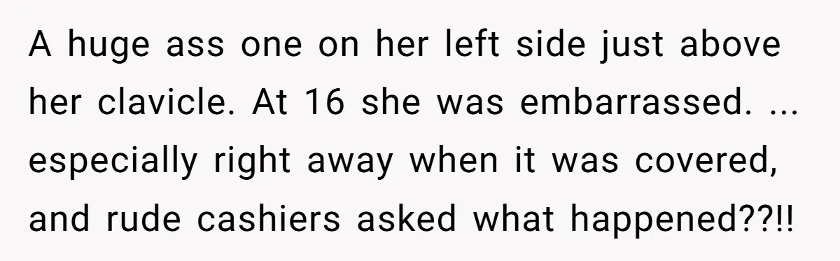 A huge ass one on her left side just above her clavicle. At 16 she was embarrassed. ... especially right away when it was covered, and rude cashiers asked what...
