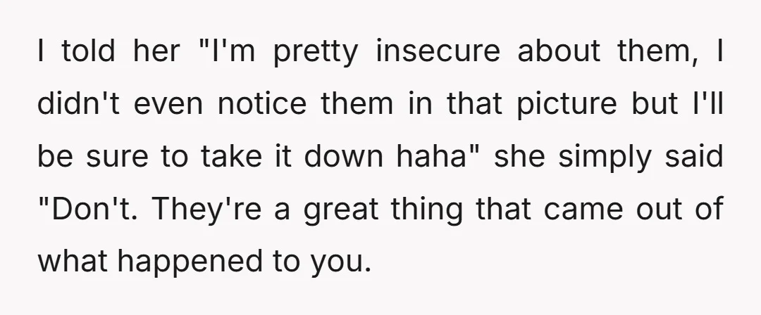 I told her "I'm pretty insecure about them, I didn't even notice them in that picture but I'll be sure to take it down haha" she simply said "Don't. They're...