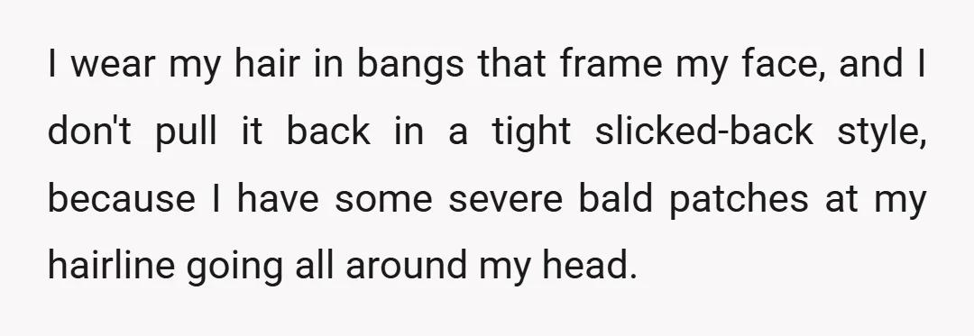 Basically, it's the worst at the top of my forehead and going down along the sides to behind my ears.